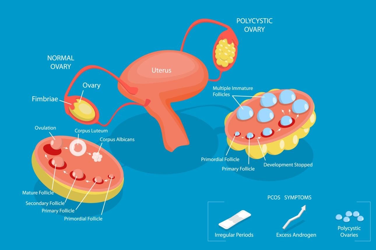 Microplastics in Human Blood: Health Risks, Hormones & Prevention 5 1 1
